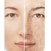 Dry Skin Causes and Solutions