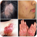 All Skin Diseases and Treatment- A to Z