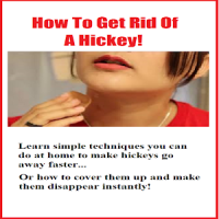 How To Get Rid Of A Hickey