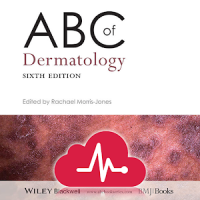 ABC Dermatology for Nurses and Medical Students