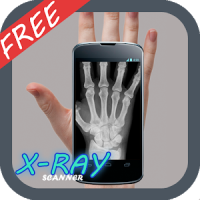 Xray Scan Prank